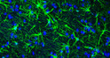 IHC staining rat brain astrocytes using anti- antibodygreen fluorescence with DAPI STJA0040598