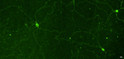 ICC staining melanopsin in mouse retinal tissue using chicken antibody STJA0040614