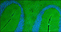 IHC staining rat brain cerebellum using chicken polyclonal antibody at 100X magnification STJA0040617