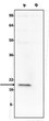 Western blot antibody detection in transfected vs mock COS-7 cell lysates STJA0040633
