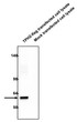 Western blot WB analysis using antibody on transfected COS-7 cell lysates STJA0040641