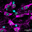 ICC staining TH neurons in mouse brain ventral tegmental area-substantia nigra STJA0040644