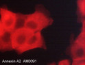ICC staining Annexin A2 in human A431 cells using antibody with DyLight 594 detection STJA0041043