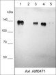 Western blot Axl protein detection in multiple human carcinoma cell lines using antibody STJA0041046