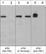 Western blot ATM phosphorylation in A431 cells with phosphatase treatment comparison STJA0041054