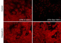 ICC labeling ATM Ser-1981 phosphorylation in A431 cells using antibody STJA0041054