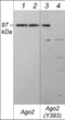 Western blot analysis A431 cells using rat monoclonal anti-Ago2 antibody STJA0041057