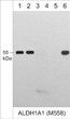 Western blot using antibody detecting ALDH1A1 in A431HepG2PC3and Jurkat cell lysates STJA0041058
