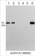 Western blot using antibody ALDH1A1 detection in A431HepG2PC3and Jurkat cells STJA0041059