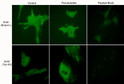 ICC staining anti-Actin antibodies in C2C12 cells with blocking peptide controls STJA0041065