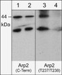 WB analysis A431 cells Arp2 detection with phosphatase treatment comparison STJA0041071