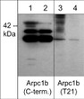 Western blot Arpc1b phosphorylation in A431 cells with phosphatase treatment comparison STJA0041075