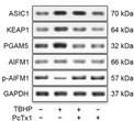 Western blot ASIC1KEAP1PGAM5and phospho-AIFM1 detection using antibody STJA0041080