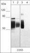 Western blot analysis CD55 using antibody on MDA-MB-231 cell lysate and recombinant proteins STJA0041095