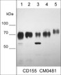Western blot CD155 detection in human carcinoma cell lines using antibody STJA0041100