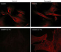 ICC staining caveolin-1 phosphorylation in rabbit spleen fibroblasts using antibody with Cy3 STJA0041116