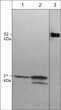 ICC staining rat A7r5 cells using Anti-Cdc42 antibody with DyLight 594 detection STJA0041124