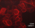 ICC staining CD44 in MCF7 cells using antibody with DyLight 594 detection STJA0041134