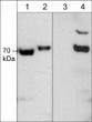 western blot CRMP2 detection in rat PC12 cells with calyculin A treatment STJA0041152