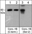 Western blot anti-Coronin-1B antibody phosphorylation in A431 cells STJA0041153