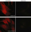 ICC staining coronin-1B in rabbit spleen fibroblasts using antibody with Cy3 detection STJA0041153