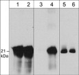 WB analysis A431 cells caveolin-1 detection with and without pervanadate stimulation STJA0041155