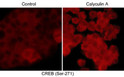 ICC staining phosphorylated CREB in A431 cells using antibody with DyLight 594 STJA0041165