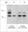 Western blot CXCR4 phosphorylation in Jurkat cells with phosphatase treatment comparison STJA0041168