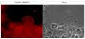ICC staining DAAM1 in A431 cells using mouse monoclonal antibody with DyLight 594 STJA0041172