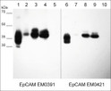Western blot EpCAM detection in cancer cell lysates using mouse monoclonal antibody STJA0041185