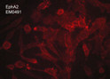 ICC staining EphA2 in MDA-MB-231 breast carcinoma cells using antibody STJA0041186