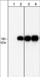 Western blot A431 cells EGFR phosphorylation at Tyr-1101 using antibody STJA0041189