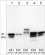 Western blot anti-EB2 antibody detection EB proteins in mouse brain tissue STJA0041196