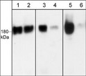 Western blot A431 cells EGFR phosphorylation detection using antibody STJA0041201