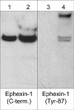 Western blot analysis Ephexin-1 phosphorylation in human A431 cells STJA0041207
