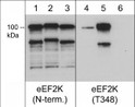 Western blot anti-eEF2K antibody phosphorylation states in recombinant human eEF2K STJA0041211