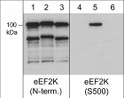 Western blot recombinant human eEF2K phosphorylation states with anti-eEF2K antibodies STJA0041213