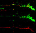 ICC staining Fascin Ser-39 phosphorylation red vs F-actin green in chick DRG neurons STJA0041230