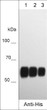 Western blot DDR1 protein detection using anti-His Tag antibody at three dilutions STJA0041240