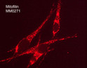 ICC staining mitofilin in human MeWo cells using antibody with DyLight 594 detection STJA0041267