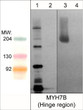 Western blot MYH7B detection in mouse brain and extraocular muscle tissue STJA0041277