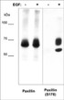 Western blot A431 cells Paxillin detection using antibody with EGF treatment STJA0041308