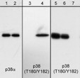 Western blot p38 phosphorylation in A431 cells with pervanadate treatment STJA0041310