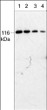 Western blot mouse brain tissue probed with anti-PYK2 antibody at multiple dilutions STJA0041315