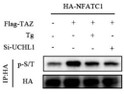 Western blot NFATC1 phosphorylation in HEK-293T cells using antibody at 12000 dilution STJA0041322