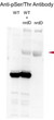 Western blot WB nrdD in vitro kinase assay using serine-threonine antibody  STJA0041322