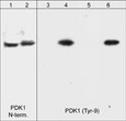 Western blot A431 cells anti-PDK1 antibody reactivity with pervanadate treatment STJA0041332