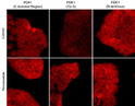 ICC staining PDK1 phosphorylation in A431 cells using antibody with DyLight 594 detection STJA0041333