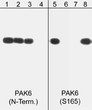 Western blot PAK6 phosphorylation with phosphatase treatment and peptide competition STJA0041338