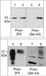 Western blot anti-Prion protein detection in recombinant protein and PC3 cell lysates STJA0041349